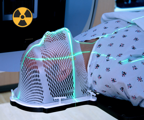 Ochrona Radiologiczna Pacjenta dla Radioterapi
