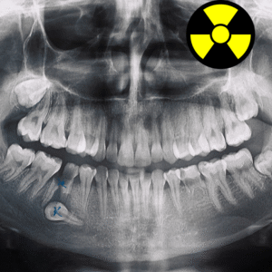 kurs ochrona radiologiczna pacjenta dla stomatologów