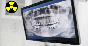 ochrona radiologiczna dla stomatologow